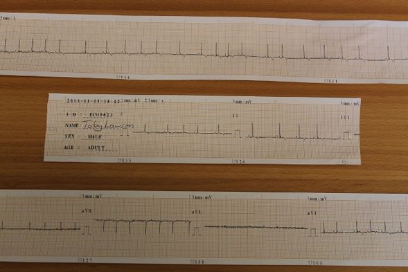 ECG For Your Pets